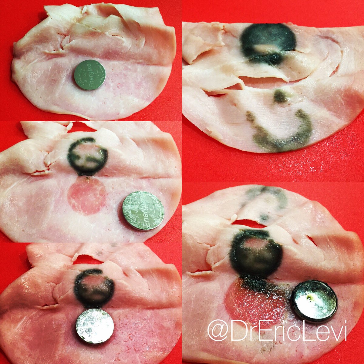 <a href="/RuralRemote/">Dr Chantal McGrath</a> at #DFTB17. Button battery injury. Here's a button battery on ham at 0, 20, 40 &amp; 60min that I did as an experiment.