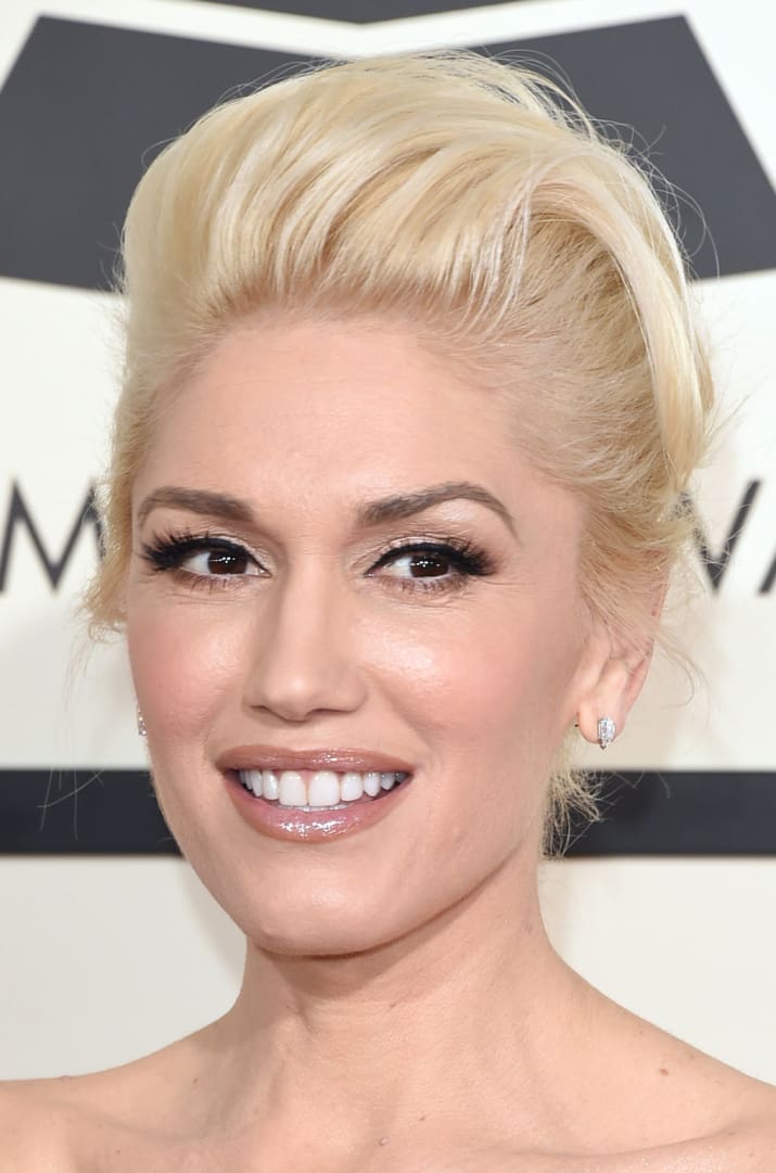 32Whites's tweet photo. Celebrities before, during &amp; after wearing braces via @BuzzFeed   https://t.co/wtmtkEN3t6 #braces #teeth https://t.co/56kJpcP5Sw