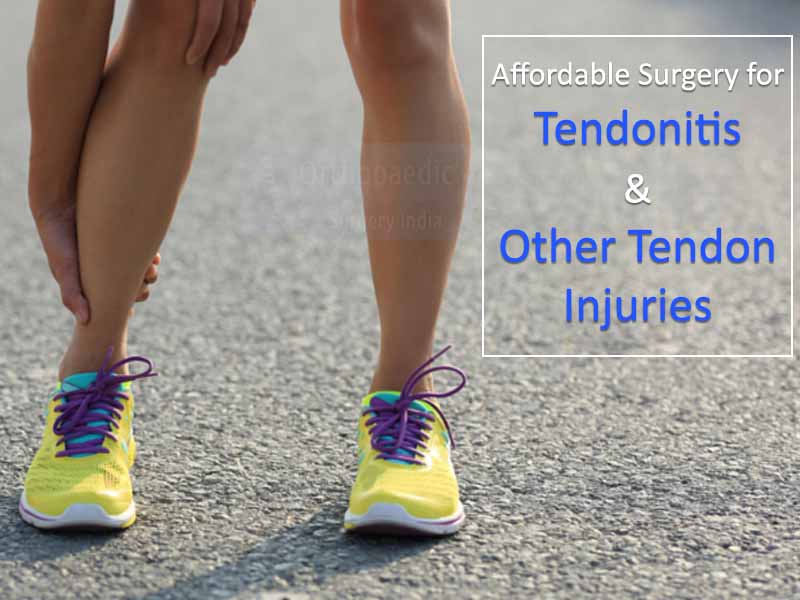 orthosurgeryin's tweet photo. Common Reasons for Undergoing #Tendon #Repair #surgery . https://t.co/tFI6zBGupu https://t.co/5fnZSGk1Hb
