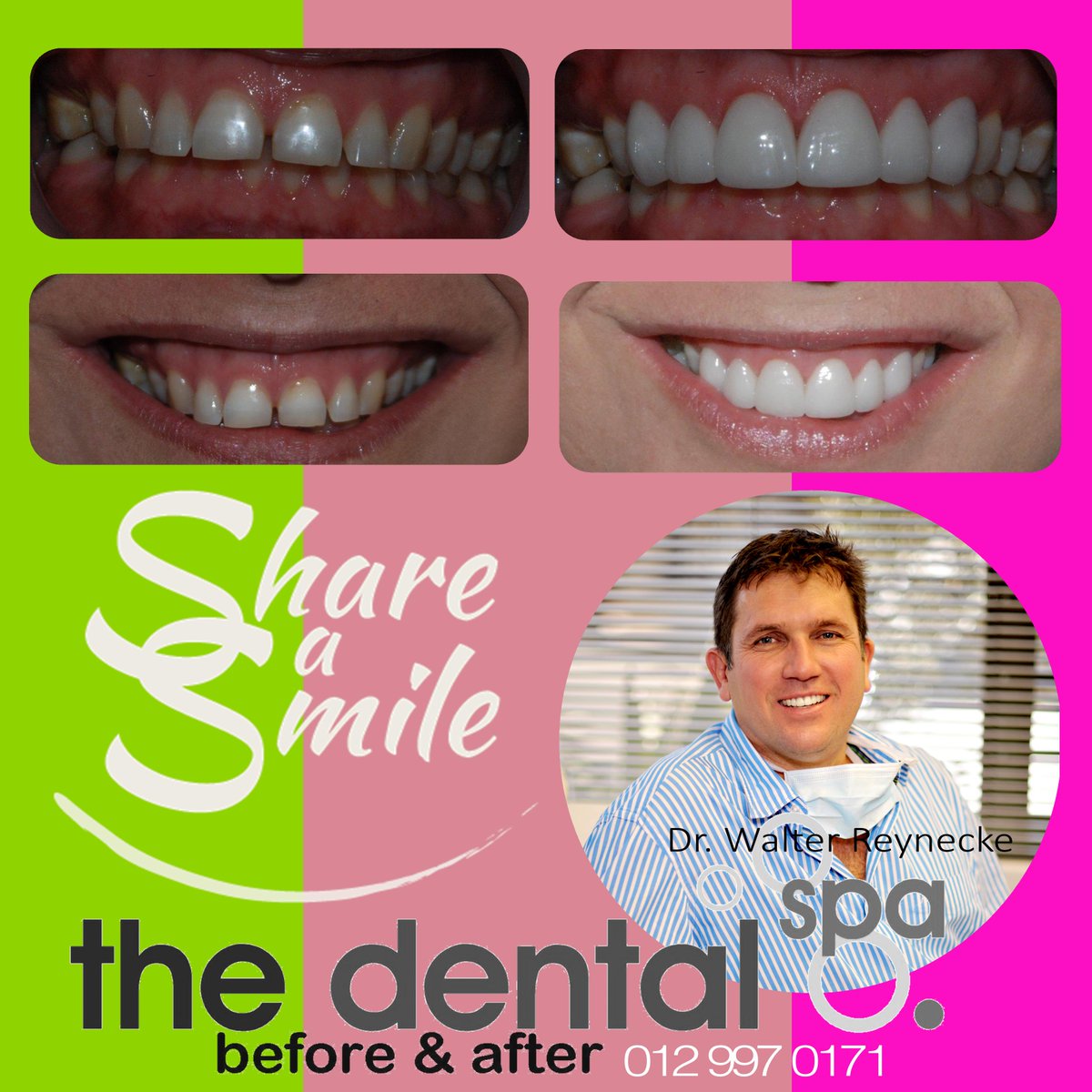 #THEDENTALSPA - Invest in your #smile. "Always borrow money from a pessimist. He won’t expect it back."