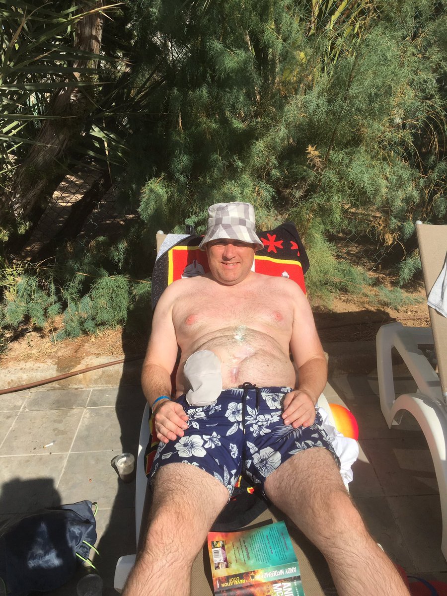 bakes1970's tweet photo. #GetYourBellyOut #TwitterTakeover #IBD #ostomy #stoma #ostomate #nocolonstillrollin https://t.co/8QZzAozFZn