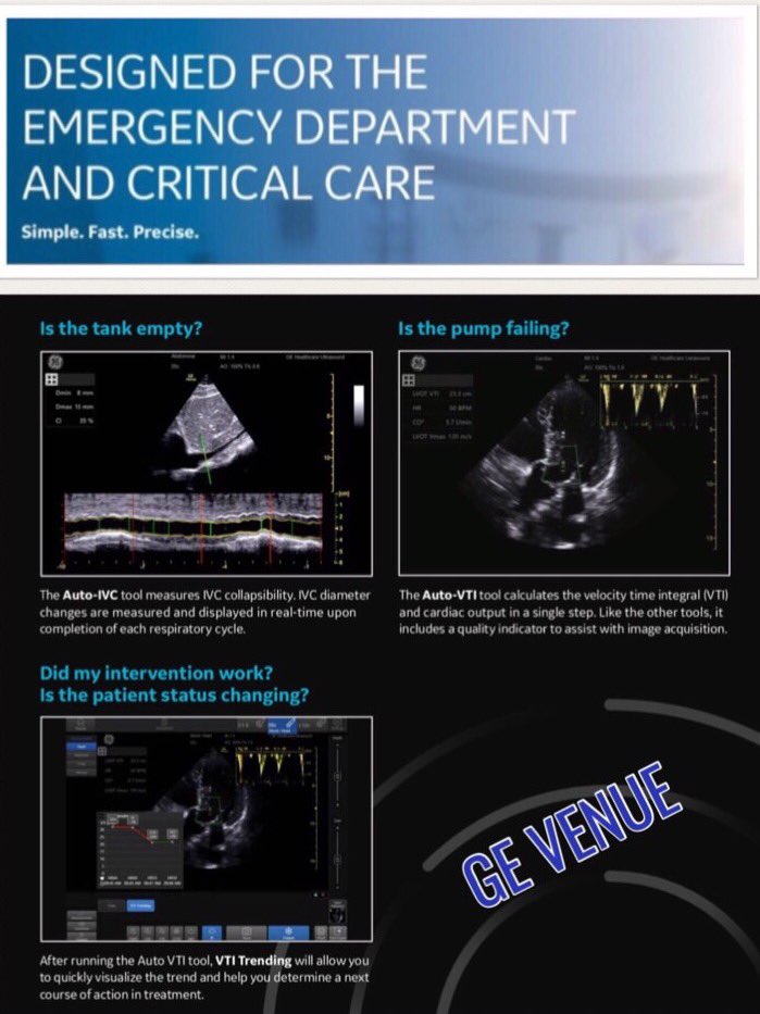 Lisa_Marlowe1's tweet photo. #SHOCK #EmergencyUltrasound #CriticalCareUltrasound #POCUS #autoIVC #autoVTI #VTItrending #autoBLines #RUSH #FAST
#GEVenue https://t.co/RzD9TSkMzG