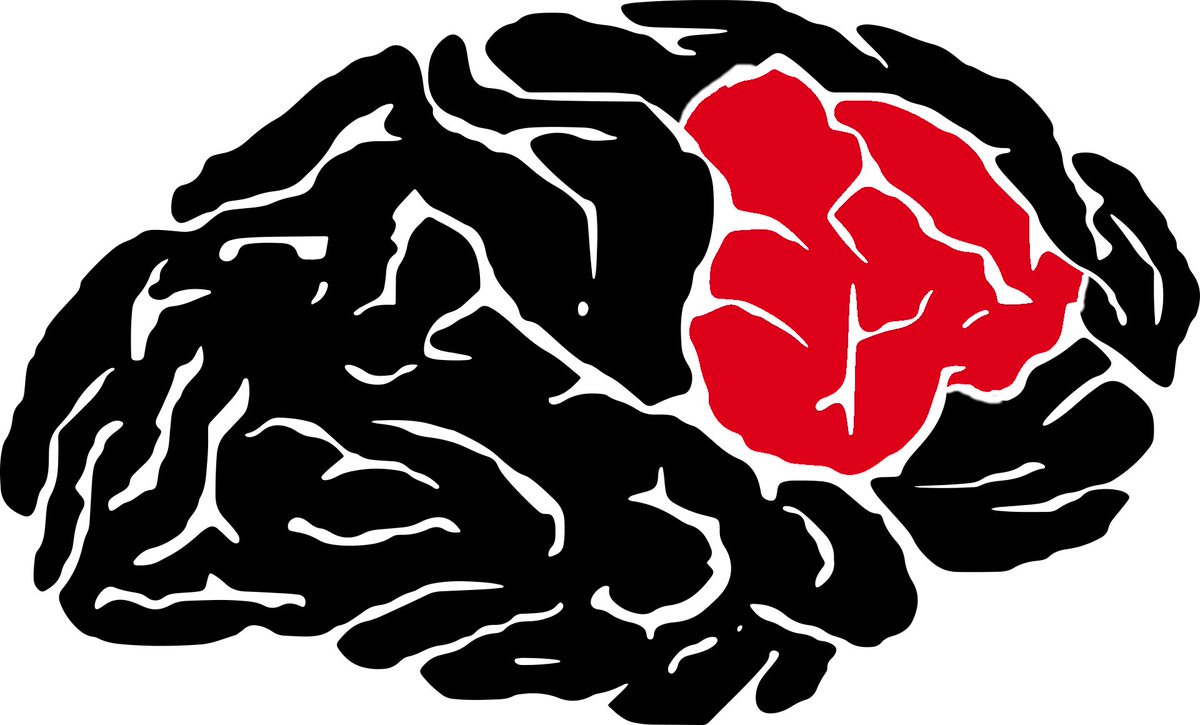 scriptmedic's tweet image. "The Writer's Guide to Head Trauma Part 1:  Lacerations, Hematomas and Skull Fractures" #posts #writingreference buff.ly/2vfsf23