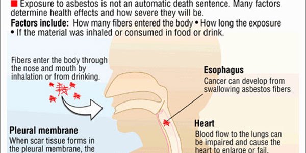AHealthBlog's tweet photo. Mesothelioma and Asbestos Exposure Infographic ➡ https://t.co/pgkCDjTbsK https://t.co/SUzHFp2MKz