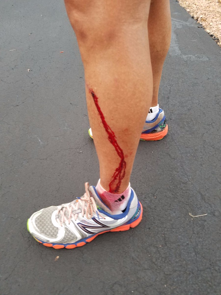 15minofPham's tweet image. Aftermath from 19-mile run yesterday. A month away from the @tcmarathon so #NoPainNoGain #idonthavetimetobleed