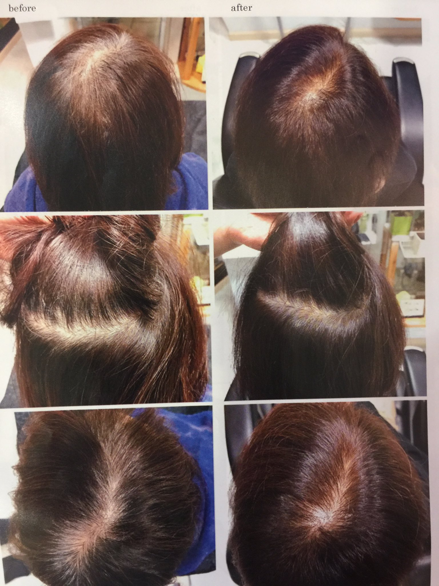 M2hairdesign Ar Twitter ジアミンかぶれの方用カラーリングです カラートリートメントやマロンなどの金属系のカラー剤より良いです お困りの方はぜひご相談下さい カラーリング ノンジアミンカラー ヘアカラー かぶれ 三田市美容院 三田市美容室 M2hairdesign Ar Twitter ジアミンかぶれの方用カラーリングです カラートリートメントやマロンなどの金属系のカラー剤より良いです お困りの方はぜひご相談下さい カラーリング ノンジアミンカラー ヘアカラー かぶれ 三田市美容院 三田市美容室