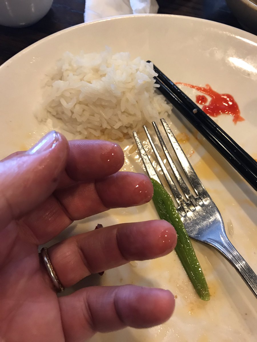 forks_ontheleft's tweet photo. Chinese food  post arm surgery in three acts:

Act 1 Lefty chopsticks

Act 2 Fork

Act 3 Fingers https://t.co/z2muWaG8D2