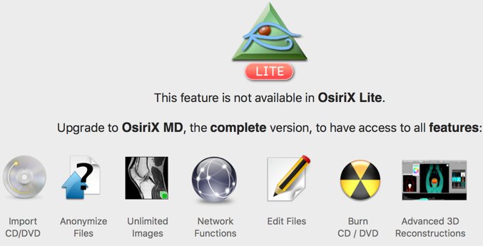 idoimaging's tweet image. That's it.  @OsiriXViewer has now removed enough features to make it not useful.  It was a great program while it lasted.