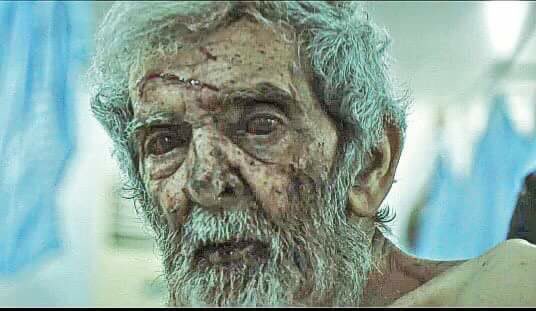asaadhanna's tweet photo. A man injured due to #INTcollation attack on #Raqqa, and he died after a while.
His eyes telling the truth, which is no body care about us https://t.co/fHePxmuhwX