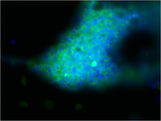 ilhamabuljadaye's tweet photo. NANOG...  😍 Gate Way to Pluripotency #stemcells #stemcell #RegenerativeMedicine #cytology #microscopy https://t.co/18WHxdsm9J