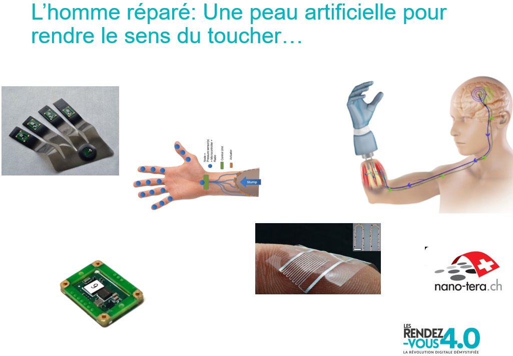 CentrePatronal's tweet photo. Objets connectés: c'est aussi et déjà pour "réparer" le corps humain @CSEMInfo @BahaaRoustom #rdvdigital #iot https://t.co/UF0slFx5gz
