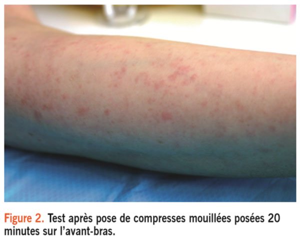 vivelesSVT's tweet photo. "keratodermie palmoplantaire aquagénique, aquadynie, prurit aquagénique idiopathique ..." On apprend on apprend à #MerEduc17 🏥 https://t.co/wphJMvOFgl