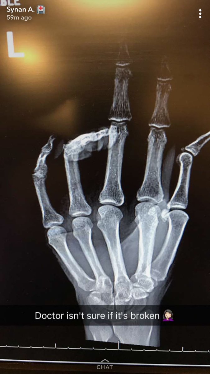 ScrubNationApp's tweet image. Oh I'm sorry, I'm not allowed to say if it's broken 🤦🏼‍♀️#nurseproblems #ScrubNationApp