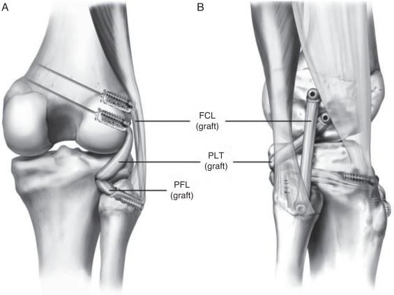 thekneedoc tweet picture