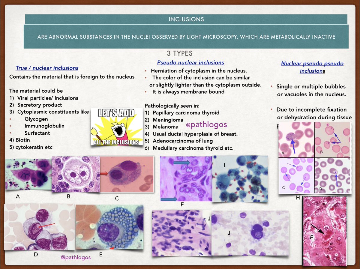 Alekh Verma A Hsv B Cmv C Auerrod Like Inclusion In Plasma Cell D Dutcher Body E Mott Cell F Pct I Melanoma J Schwannoma Pathology Usmle T Co Z5kmravnd2