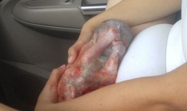 DiarioPE's tweet photo. Ainda em carro, bebê nasce dentro de bolsa aminótica
https://t.co/ZV35NrMIfG https://t.co/kGTnlcYHAq