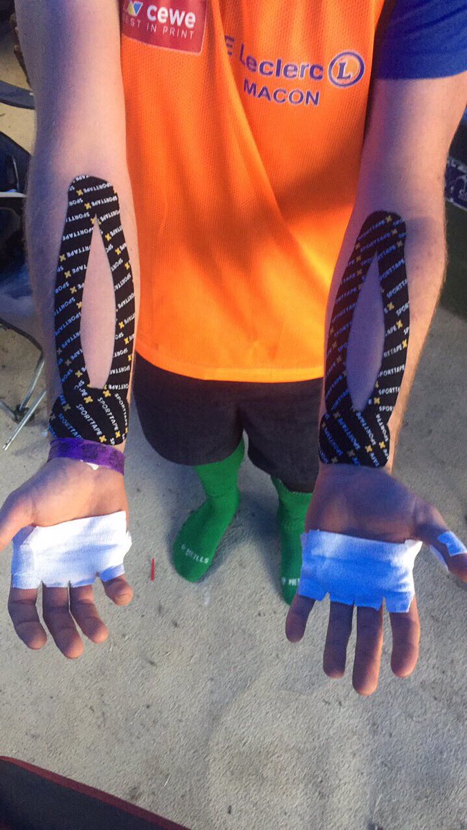 martinquad69's tweet photo. My first attempt at putting on #sporttape at the weekend for the 12hr pdv quad race #noarmpump @SPORTTAPE @PDVRacing https://t.co/XWy4c2T18m