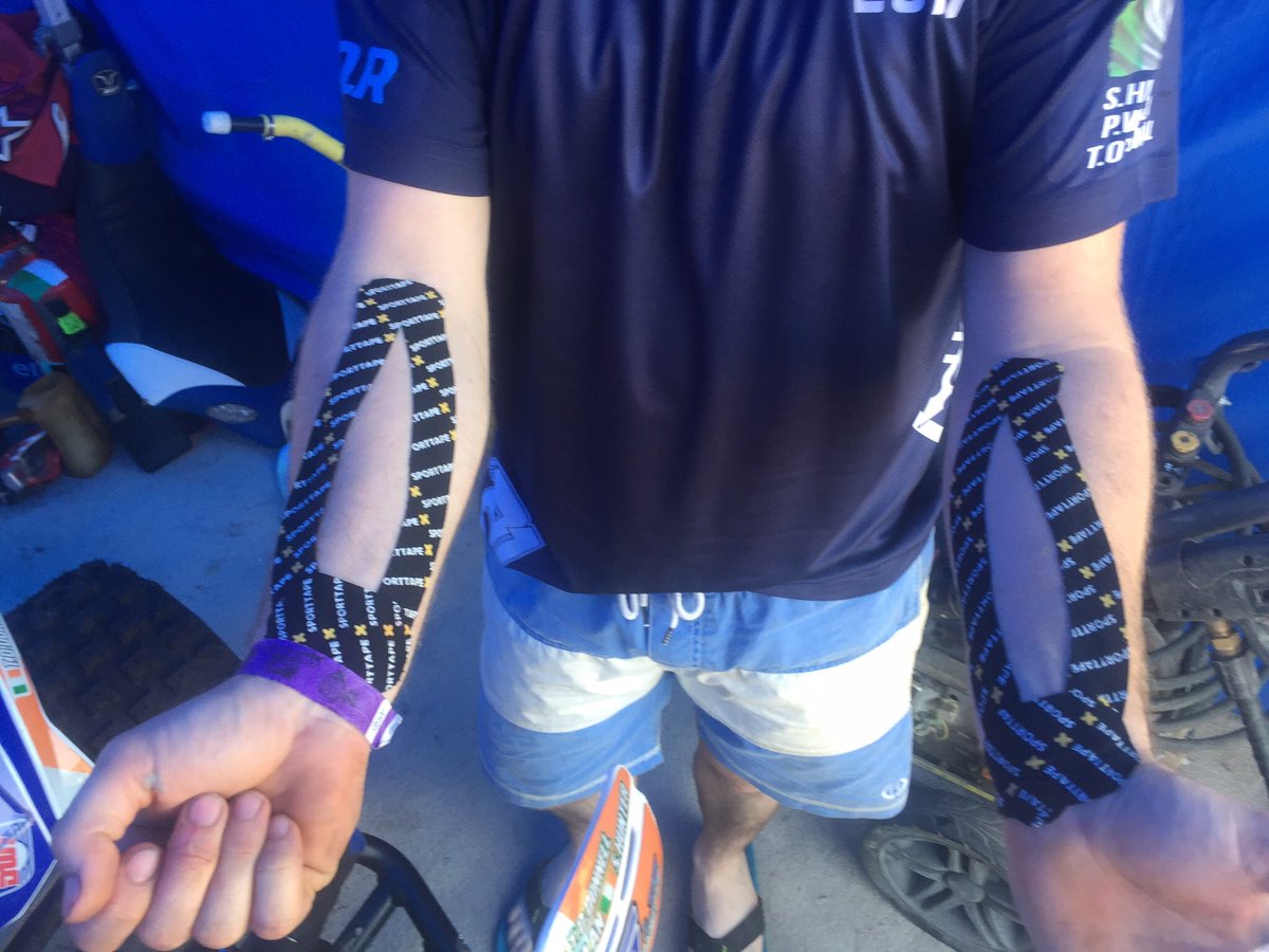 martinquad69's tweet photo. My first attempt at putting on #sporttape at the weekend for the 12hr pdv quad race #noarmpump @SPORTTAPE @PDVRacing https://t.co/XWy4c2T18m