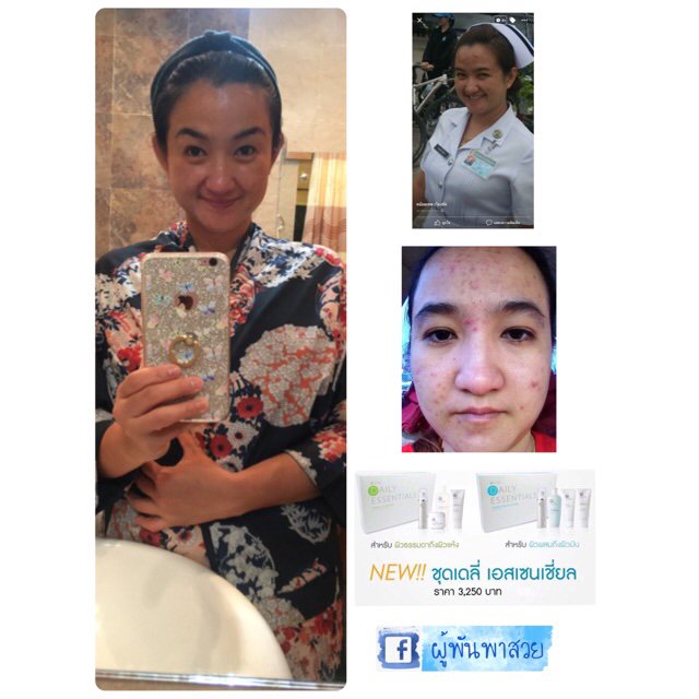 MajorJiiB's tweet photo. ขาย NuSkin ชุดเดลี่ เอ... ในราคา ฿3,250 ที่ #ShopeeTH ตอนนี้! https://t.co/XDzITmEMCM https://t.co/crvjLmnOW1