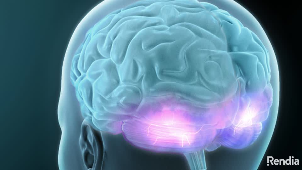 eyecarefaq's tweet photo. A really interesting video that describes the physiological development of an ocular migraine https://t.co/8zo602Dv2w https://t.co/hZYDO8EaEH