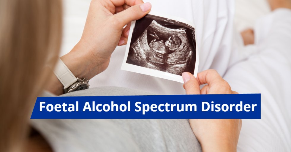 WesternCapeGov's tweet photo. 10 Facts about Foetal Alcohol Spectrum Disorder (FASD): https://t.co/mfwbHhx59q. #HealthNewsWC https://t.co/smu6p4f0th