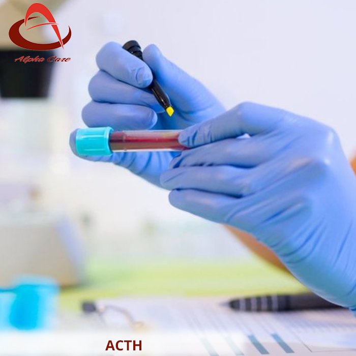 alphacarelab's tweet photo. #ACTH #harmone #health #healthcare #healthtips #ooty #nilgris #bloodlevel #cortisol #adrenocorticotropic #pituitary 
https://t.co/iDFnPVgWZe https://t.co/tplZ5f7Fs9