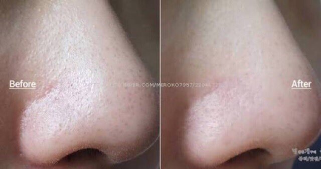 Black Paint Rubar Stick🖤730฿free EMS🚚 
-Cleansingทำค.สะอาดแบบแท่ง
-ลดสิวเสี้ยน สิวอุดตัน
-ทำความสะอาดได้อย่างล้ำลึก
ดีจริงค่าแม่ค้าคอนเฟิม🔥