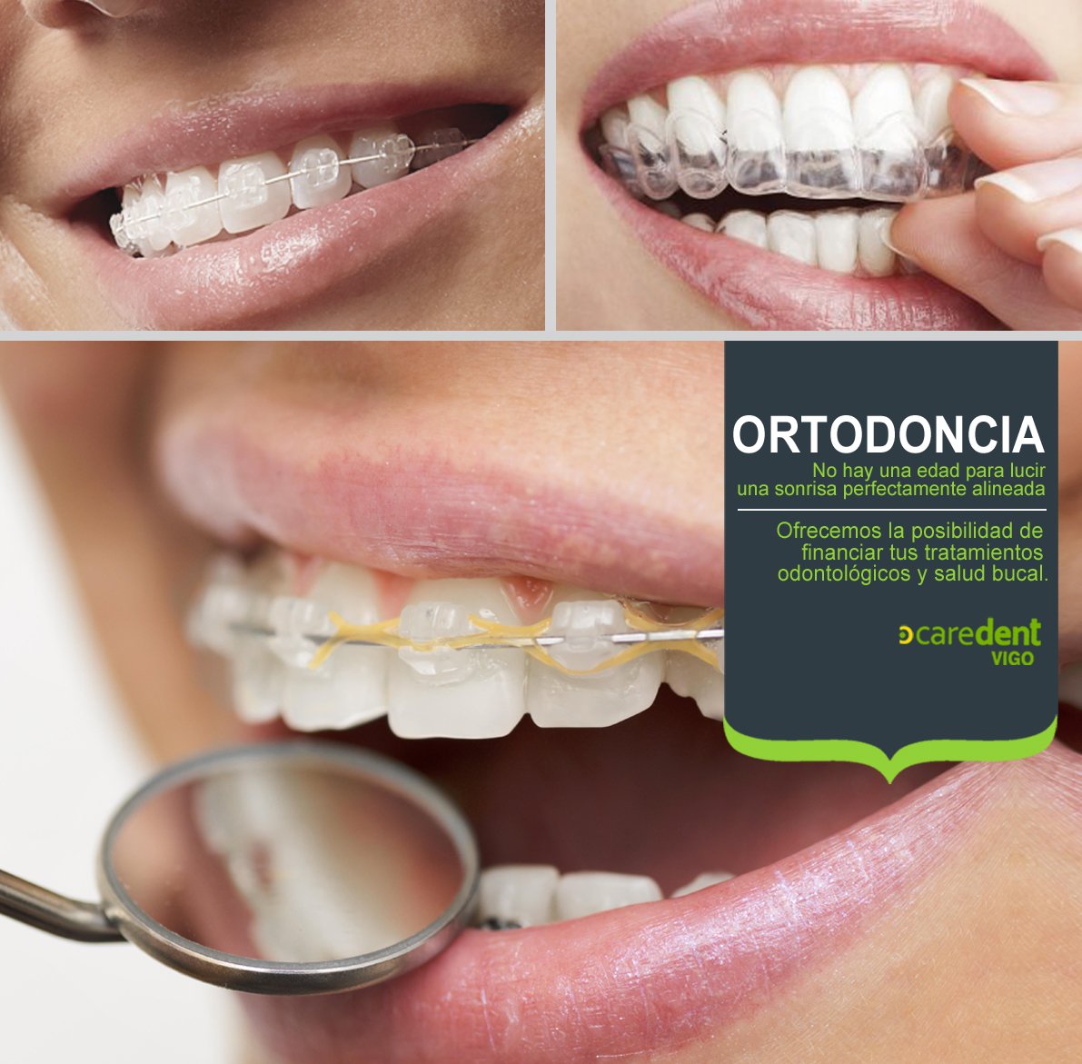 caredent_vigo's tweet photo. Los tratamientos de ortodoncia, no están ligados sólo a la infancia o adolescencia. No hay una edad para lucir una sonrisa perfecta https://t.co/k237jfB0h8