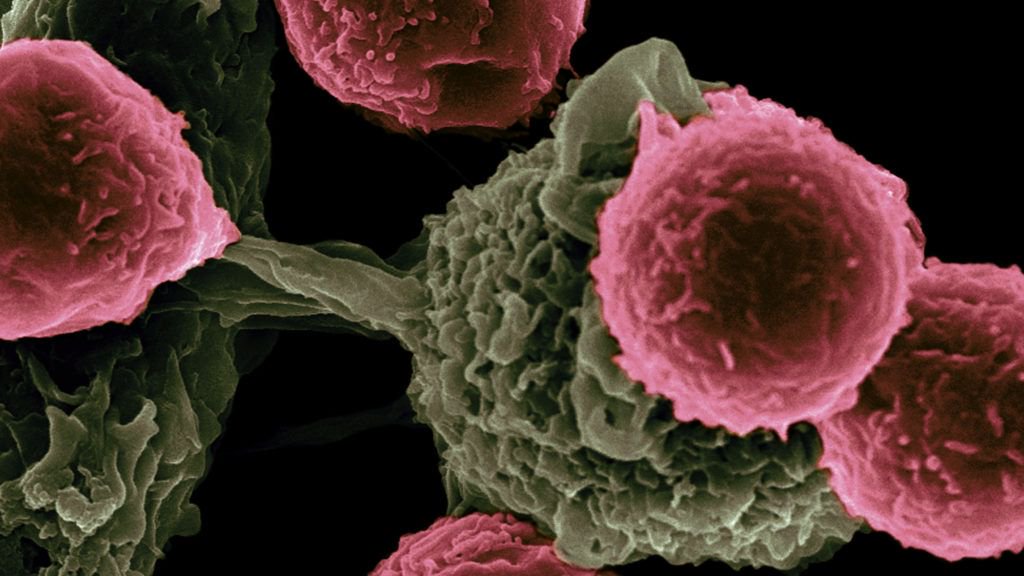 FDA approves <a href="/Novartis/">Novartis</a> CAR-T drug to treat a form of #leukemia in those aged 25 and under: go.nature.com/2vFlJSn #NMedNewsBeat