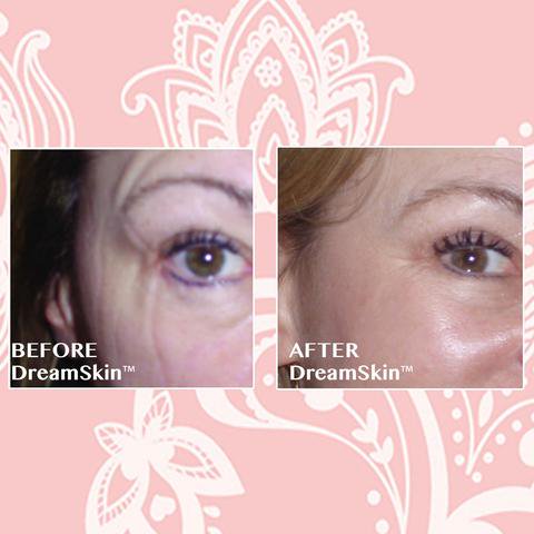 It's the FIRST proven #cosmetic pillowcase that works! Buy DreamSkin "The Fabric for Beautiful Skin" #beauty bit.ly/2jf5ici