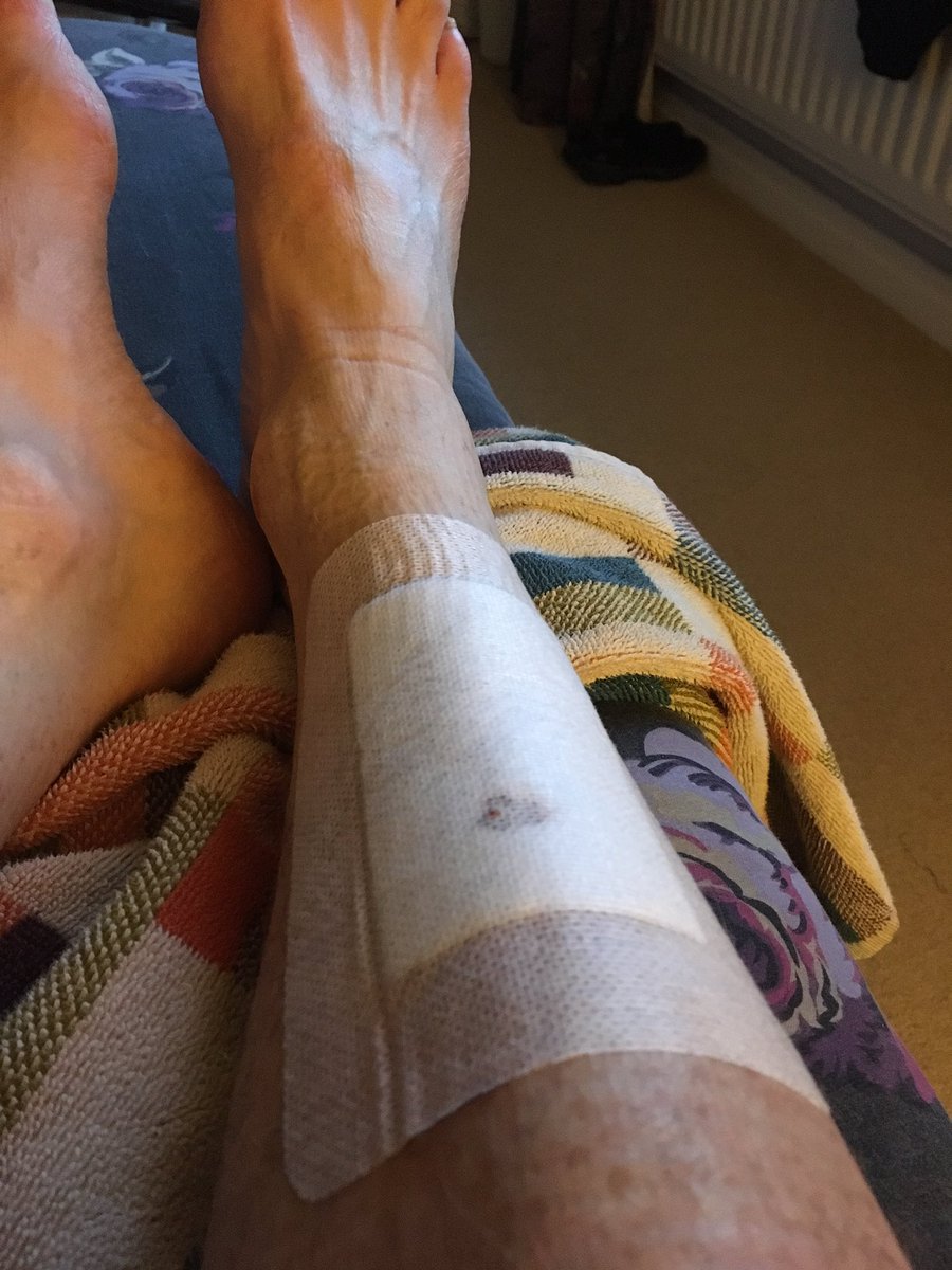 6 days on and the sad minced shin is still weeping with sorrow! 🙄
#healyaweebugger