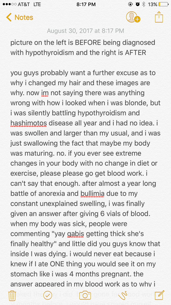 gabcake's tweet photo. ❤️hypothyroidism awareness❤️ my story 💉 https://t.co/hXMj1zof0J