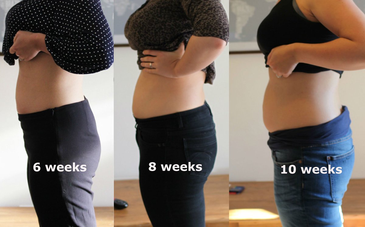 10 weeks pregnant!!!