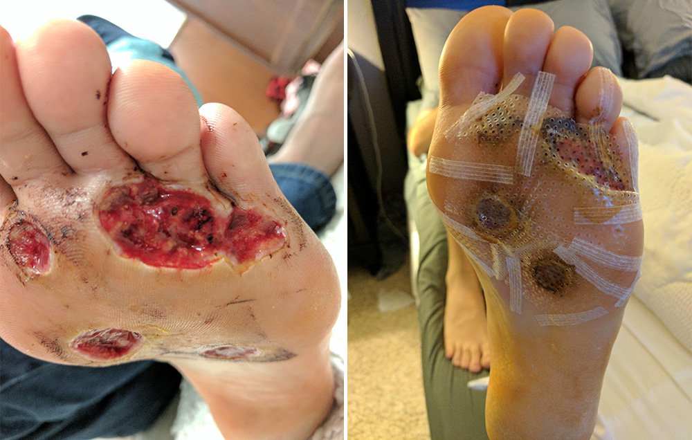 MensHealthMag's tweet photo. You will never shower barefoot at the gym after you read this: https://t.co/ZFJC2Vvpfu https://t.co/XoTZbrUl9I