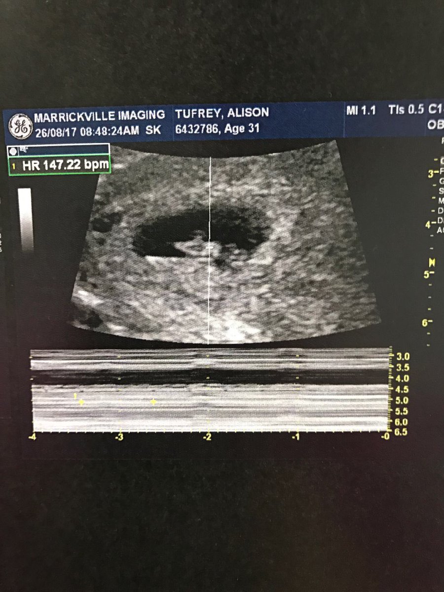 SpallK's tweet photo. You heard it here first!! #testCHUbebaby
Congratulations Simon Tufrey!! #baby2announcement
#INSAWARDSAU https://t.co/NzUd3b321h