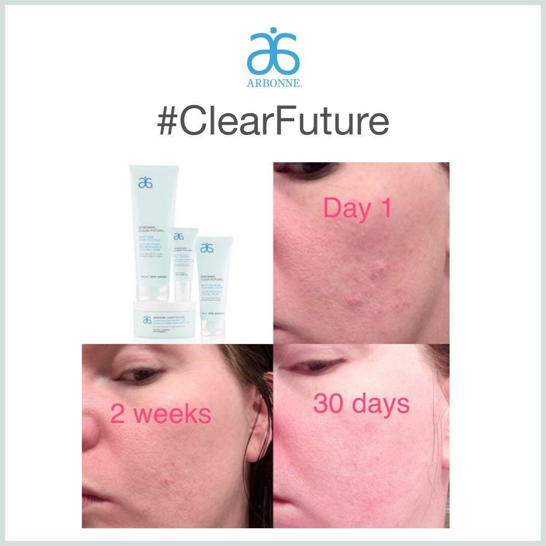 sallotsipu's tweet photo. Be sure to stock up on these amazing products, sale ends today! #Arbonne #Clearfuture #FizzSticks #ShaeButterlotionandwash https://t.co/uvFhtF8AHP