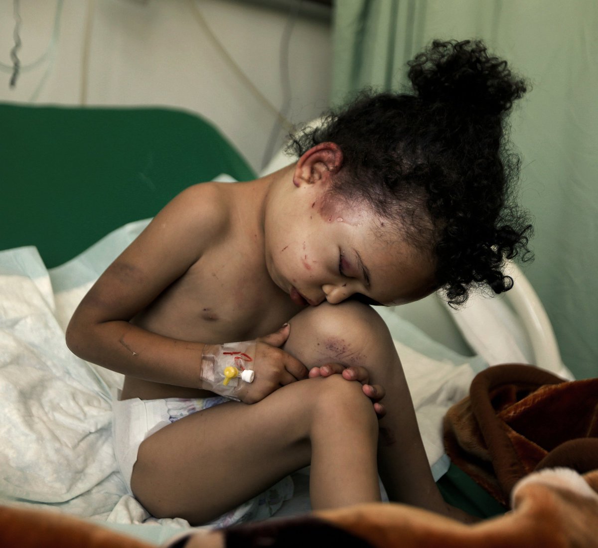 LotteLeicht1's tweet photo. This is Buthaina, the only survivor in her family of a #Saudi-coalition bombing in #Yemen last week. End impunity! https://t.co/kzbCL2zAmO https://t.co/4Av35kzS2V