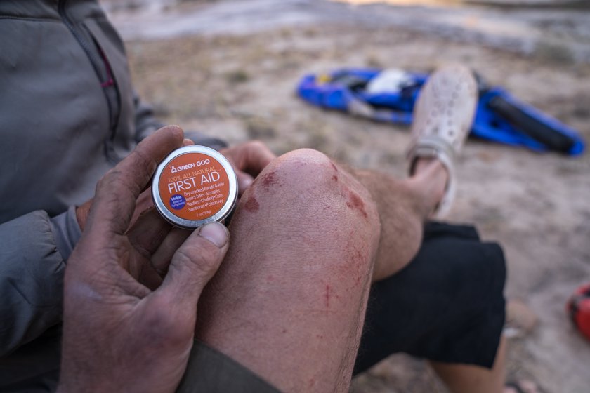 greengoohelps's tweet photo. "This little tin replaces 20 first aid products!" https://t.co/x7ZGTZZyBz @FoodTravelist #naturalfirstaid #organicfirstaid https://t.co/k7oGnbss42