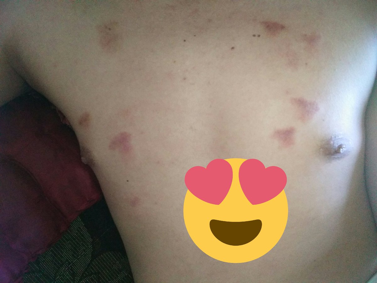SMuhtadun's tweet photo. Koleksi tato merah jambu😘😘😘 https://t.co/zRN9s9JS85