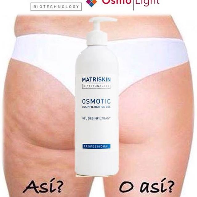 matriskin's tweet photo. Tratamiento para recuperar tu figura eliminando grasa y líquidos de los depósitos de tu cuerpo #matriskin #adelgazar #anticelulitico https://t.co/Uzy40F1ZVa