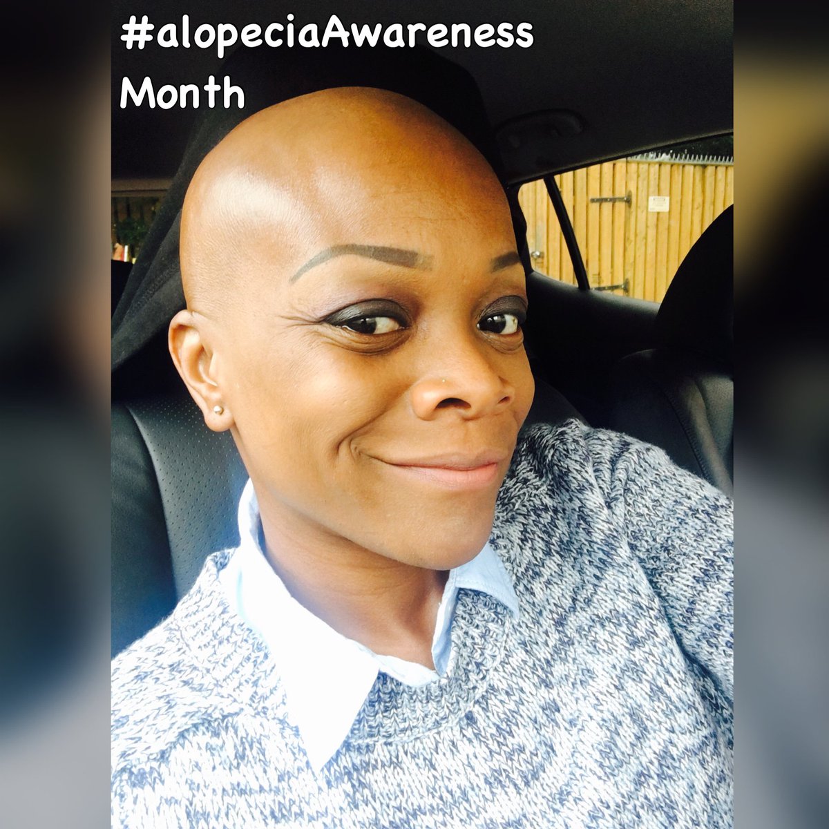 almocado's tweet photo. Hello September #alopeciaawarenessmonth #afrohair #blackhair #brownbeauty #almocado #baldie https://t.co/zxXjQsBxnz