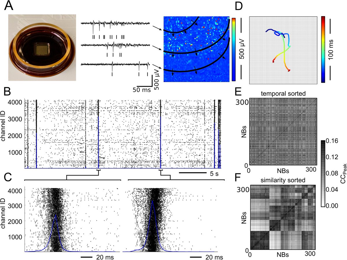 3Brain's tweet photo. New paper on #neuronal networks recorded by using #3Brain's HD #MEA !!! https://t.co/WabIcWkS2y #MEA #brain #neuroscience #Neuroimaging https://t.co/wcx3x31yzi