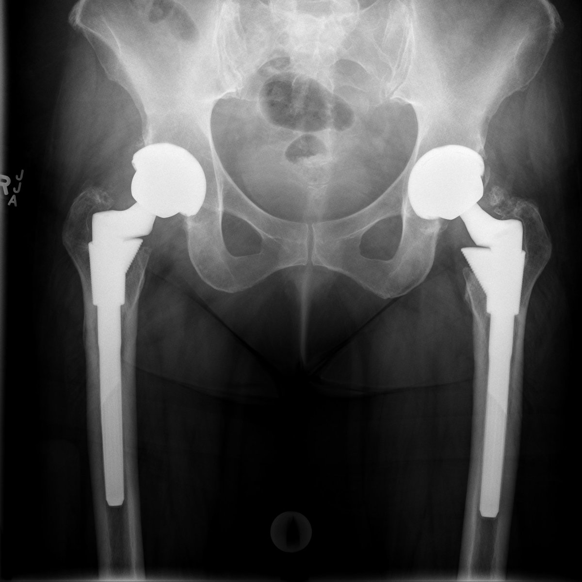 Health_Eng's tweet photo. Great #education resource in ortho care field! Surgery videos &amp; radiograph case studies av. at: https://t.co/d3Rh7MzHwt #ScienceThatHeals https://t.co/8HVMusD2gy