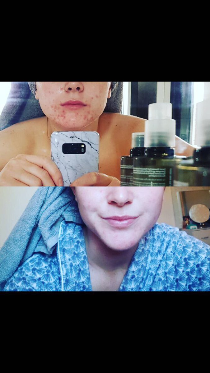 Elements Henley tweet media