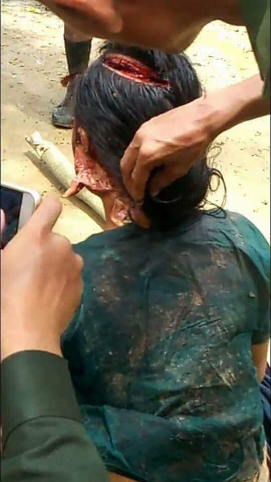 KhineMinMyat1's tweet photo. #Bangali terrorists(so call #Rohigya)attacked violence #Cheakama lady seriously and killed her young son(2year old) afont her in #Buthidaung https://t.co/gp2hHcRvYn