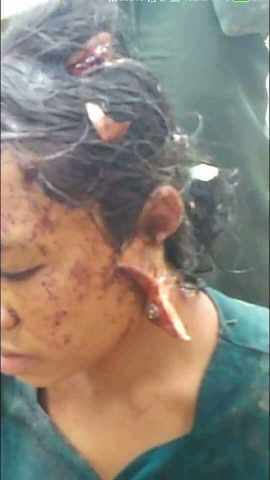 KhineMinMyat1's tweet photo. #Bangali terrorists(so call #Rohigya)attacked violence #Cheakama lady seriously and killed her young son(2year old) afont her in #Buthidaung https://t.co/gp2hHcRvYn