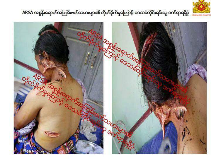 YadanarSoe4's tweet photo. Latest News on #Rakhine
#ARSA #Extremist #Terrorists News-21 https://t.co/DkCQX6ITH6