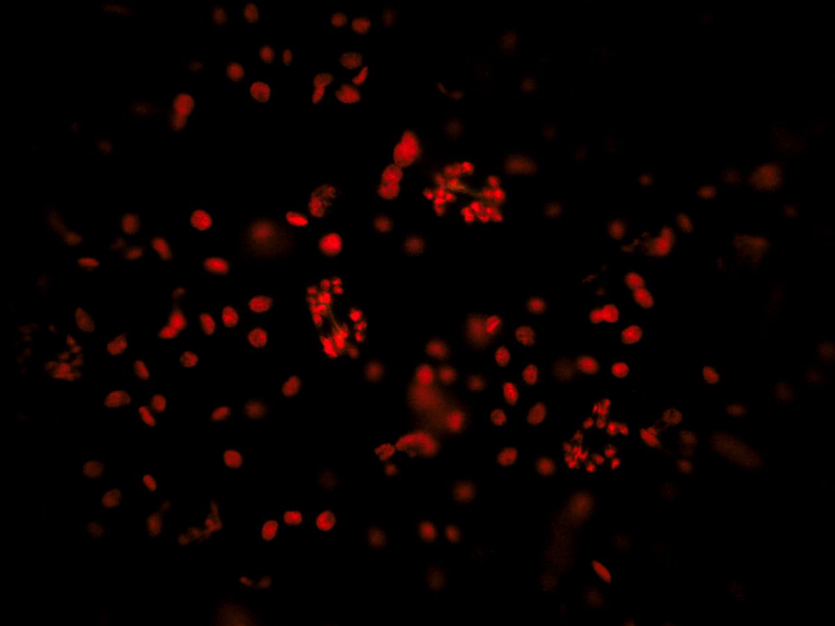 ChaoticGenetics's tweet photo. Guard cell chloroplast fluorescence, leaf peel 400X, blue excitation, single pic #Science #Biology #Botany #Photography #Microscopy #Capsium https://t.co/roSrpeX1Xf