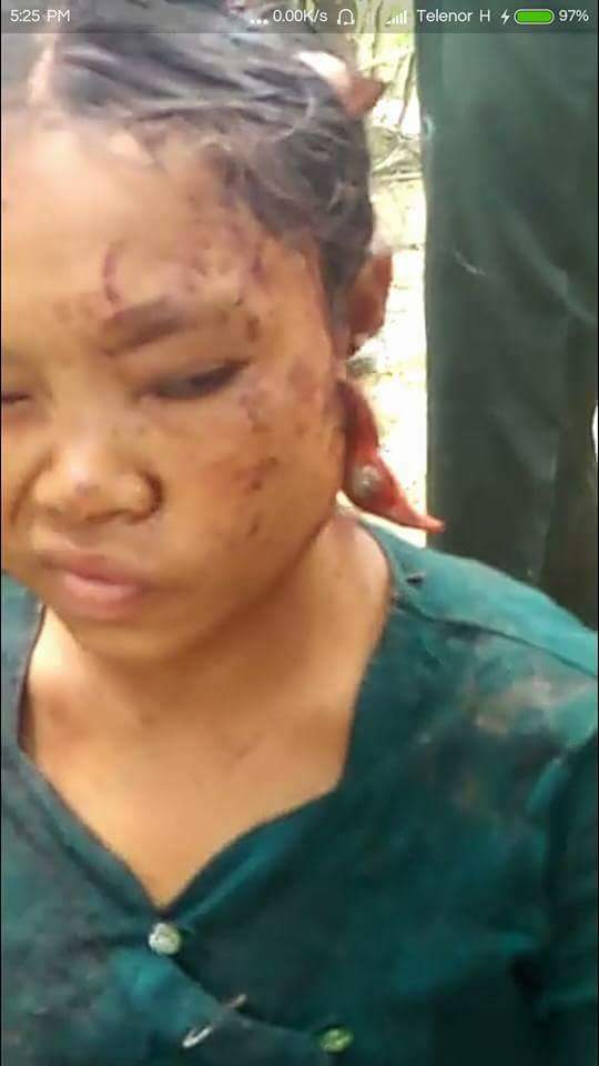 #KofiAnnan  
#Myanmar 
Arakanese girl brutally cut mercury and when terrorist Bengalis brutality of her 2-year-old boy died.