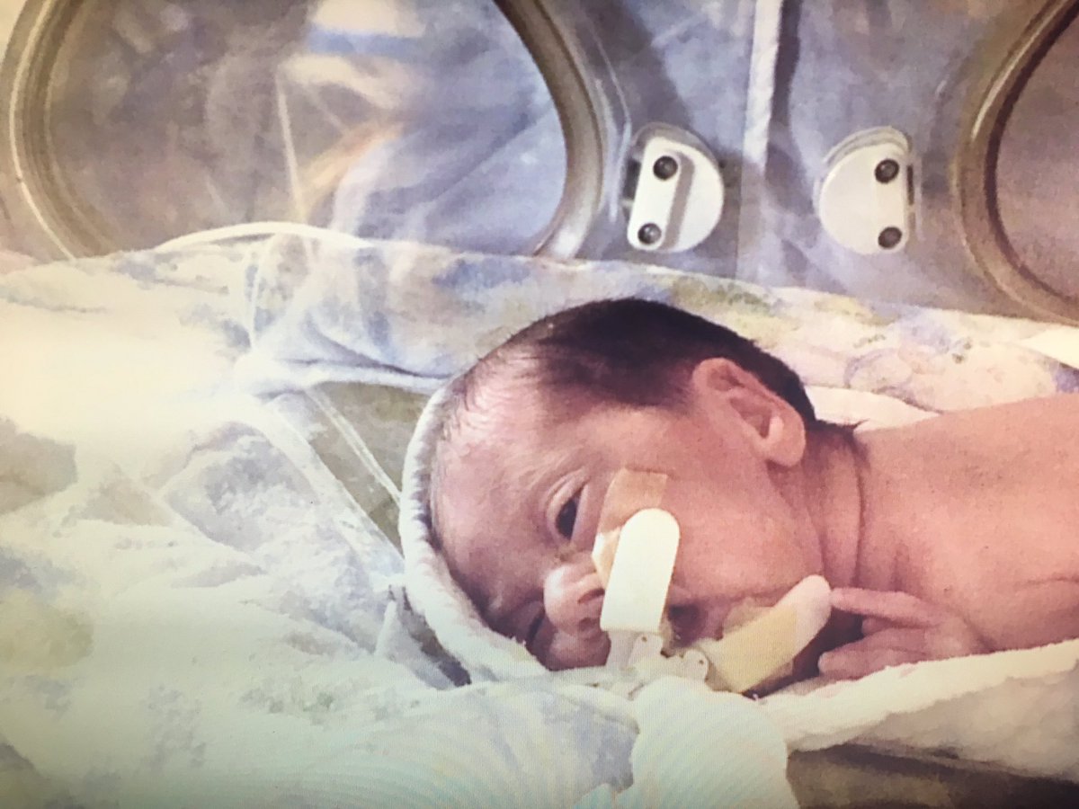 PaulByrne_1's tweet photo. Little Eva is one of 2k babies born prematurely here each year. See her story on #3News @5.30 @BurnShaveCUMH @HSELive @CUH_Cork @CUHCharity https://t.co/Y94wD0rjzw